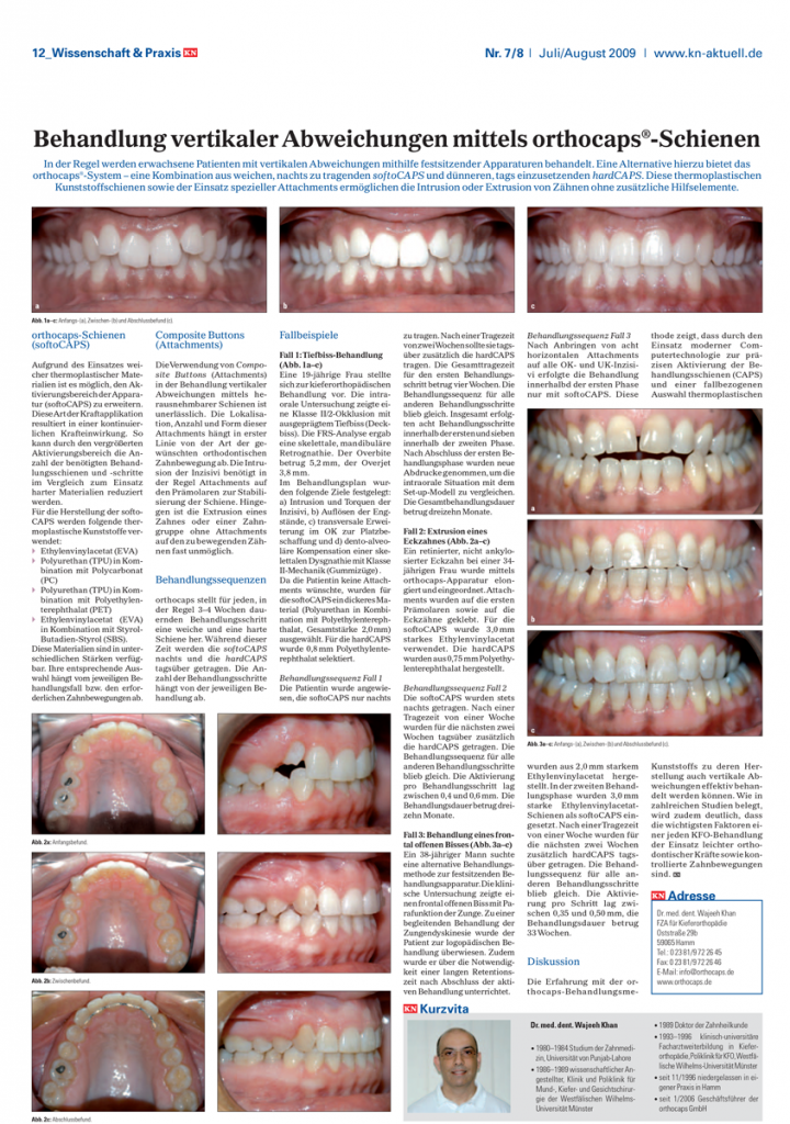 Behandlung vertikaler abweichungen mittels orthocpas