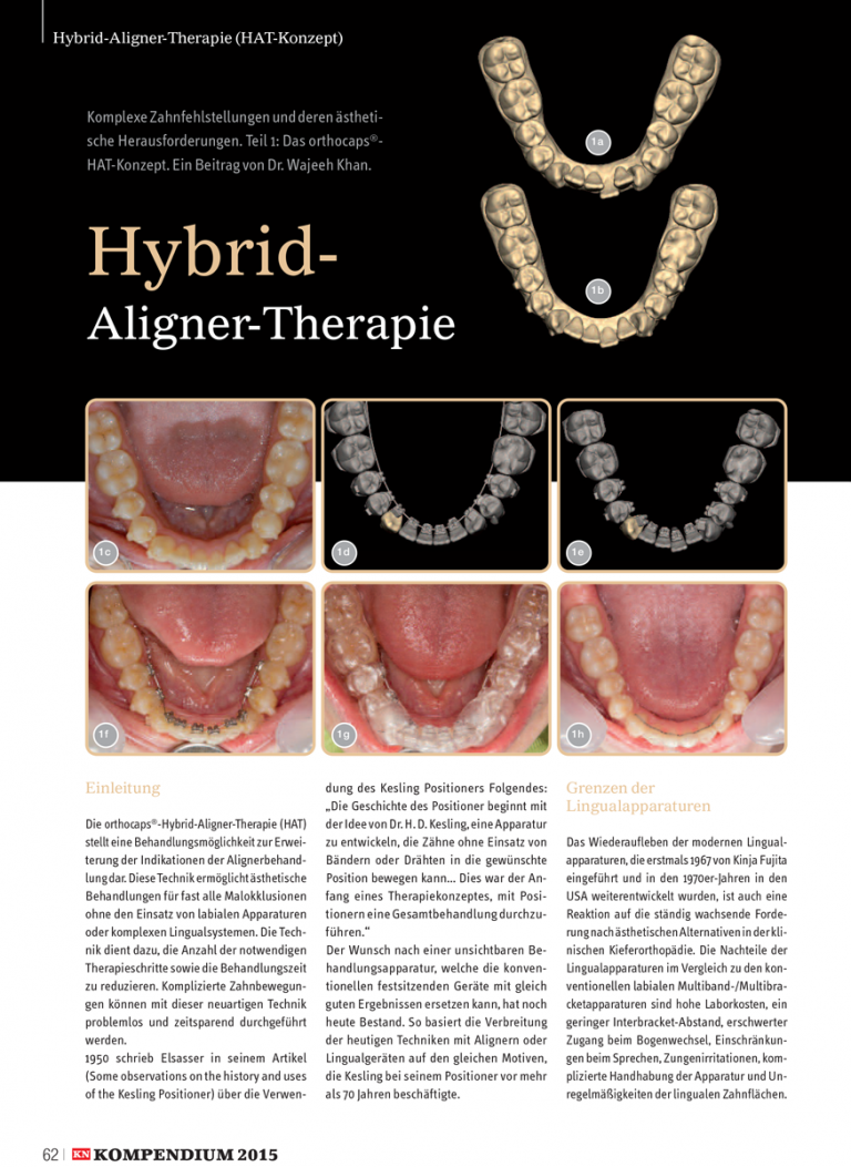Hybrid-aligner-therapie